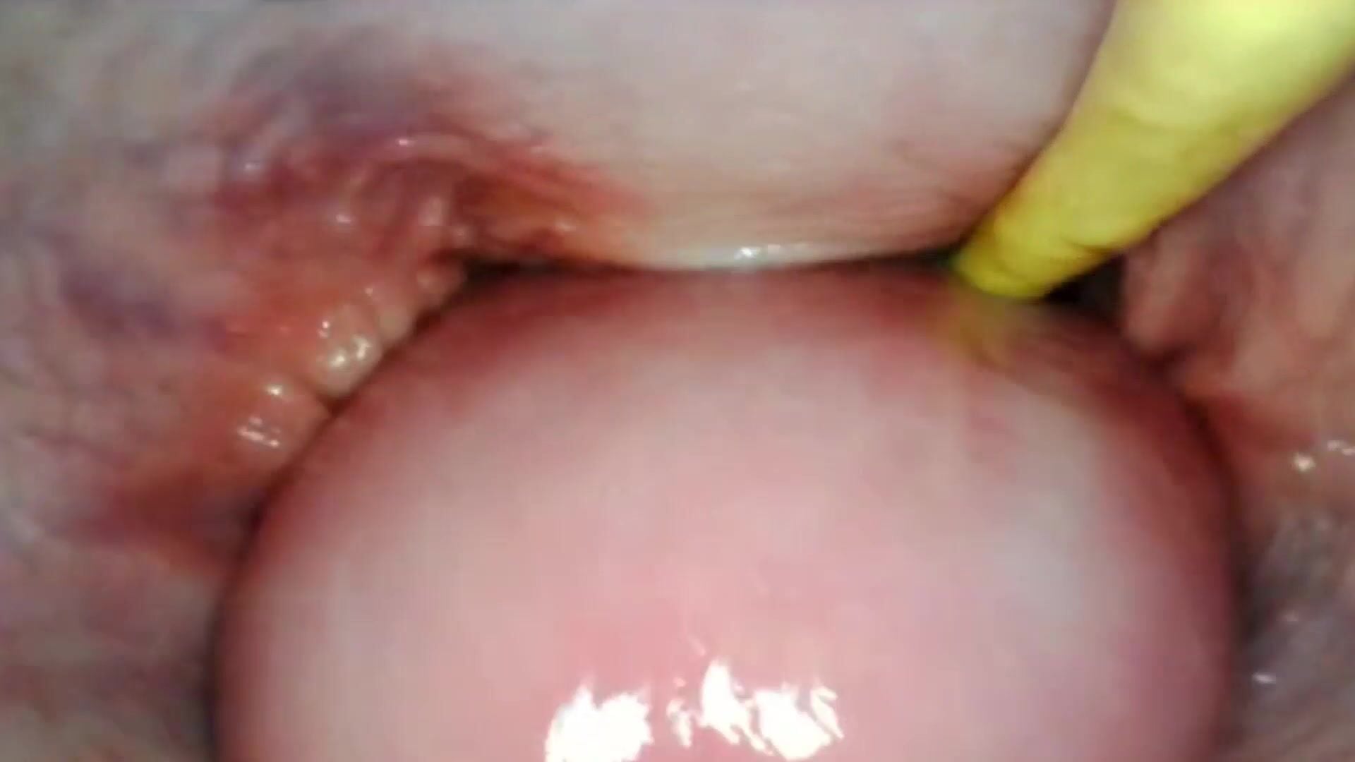 AMAZING INTERNAL POV. CAMERA INSIDE HER PUSSY WHILE I FILL HER WITH CUM